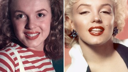 Marilyn monroe surgery