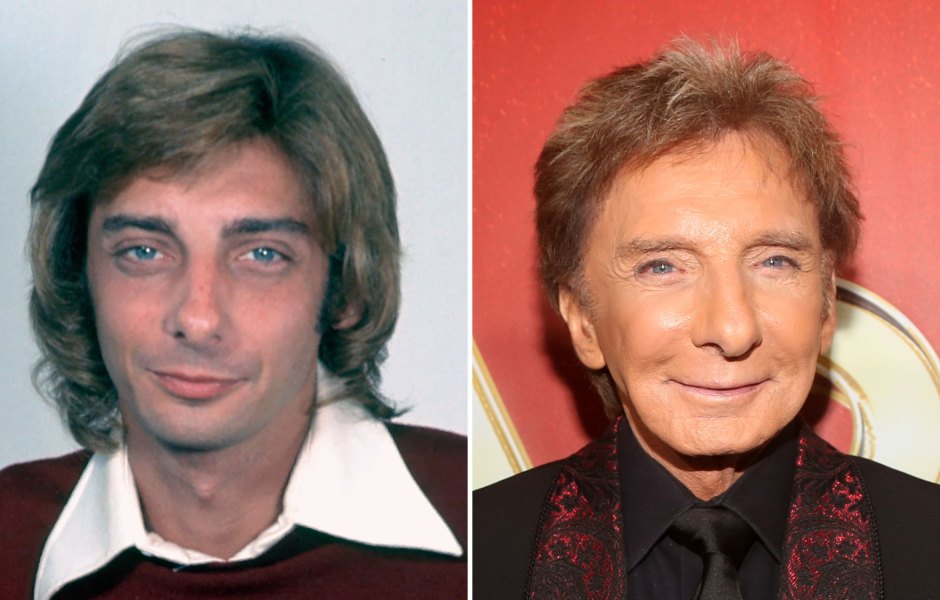 Did Barry Manilow Have Plastic Surgery? Transformation Photos