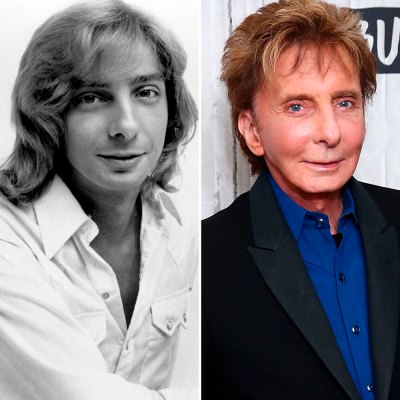 barry manilow plastic surgery getty images