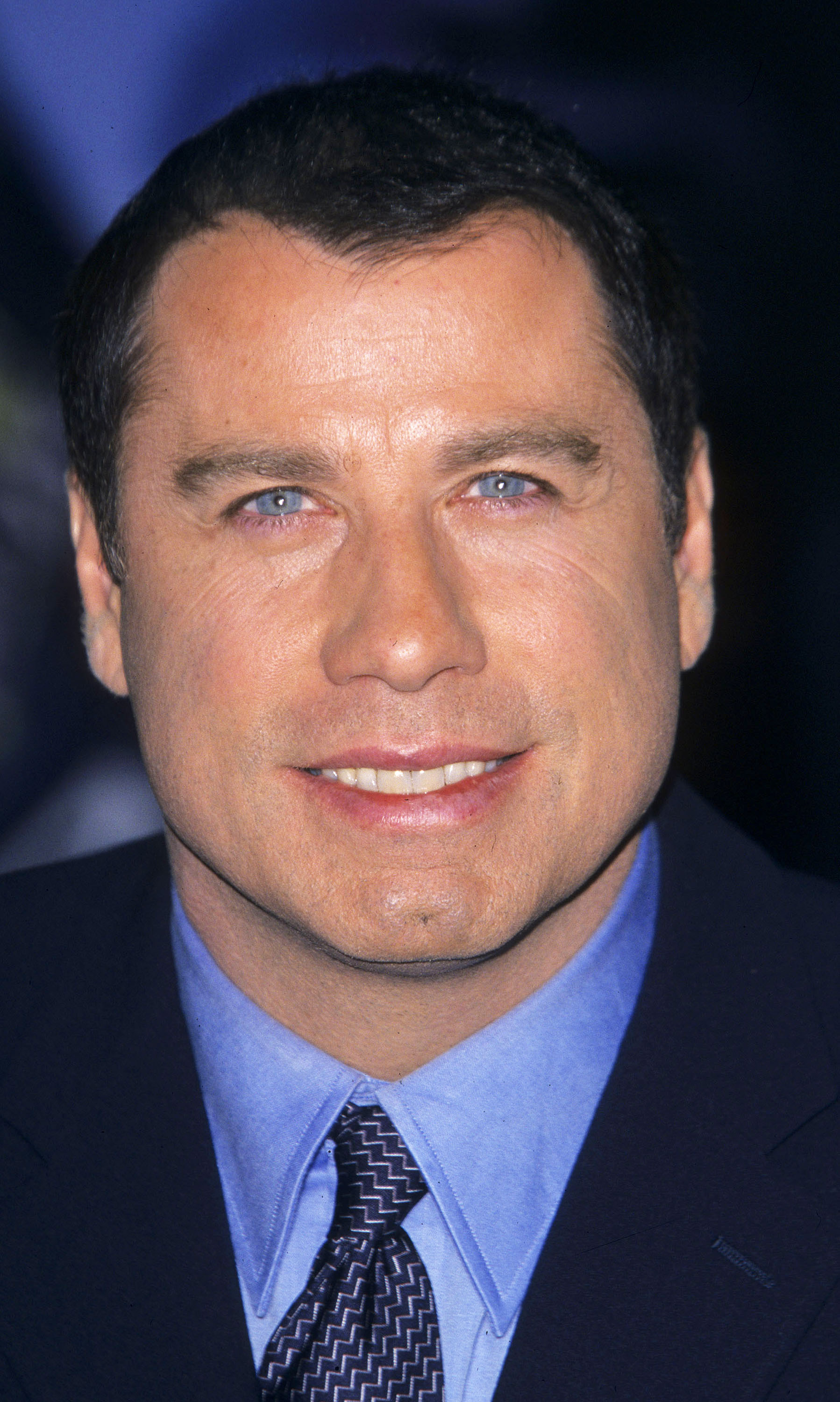 John Travoltas Hair Transplantation  MCT