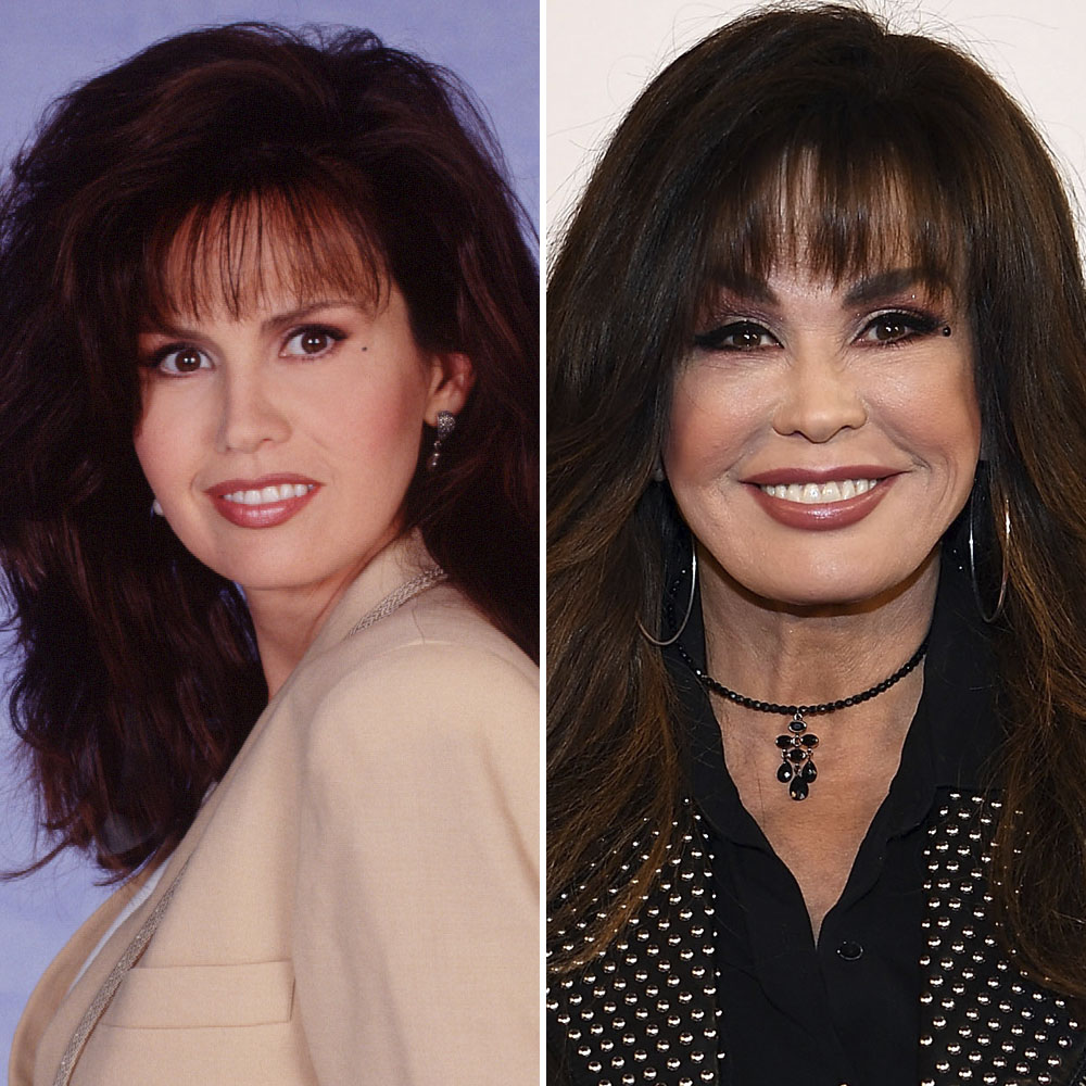 Has Marie Osmond Gotten Plastic Surgery? Our Experts Weigh In!