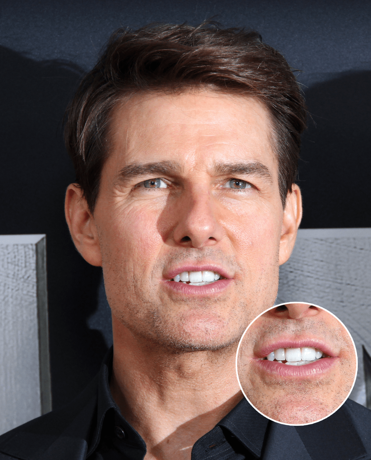 tom cruise tooth face