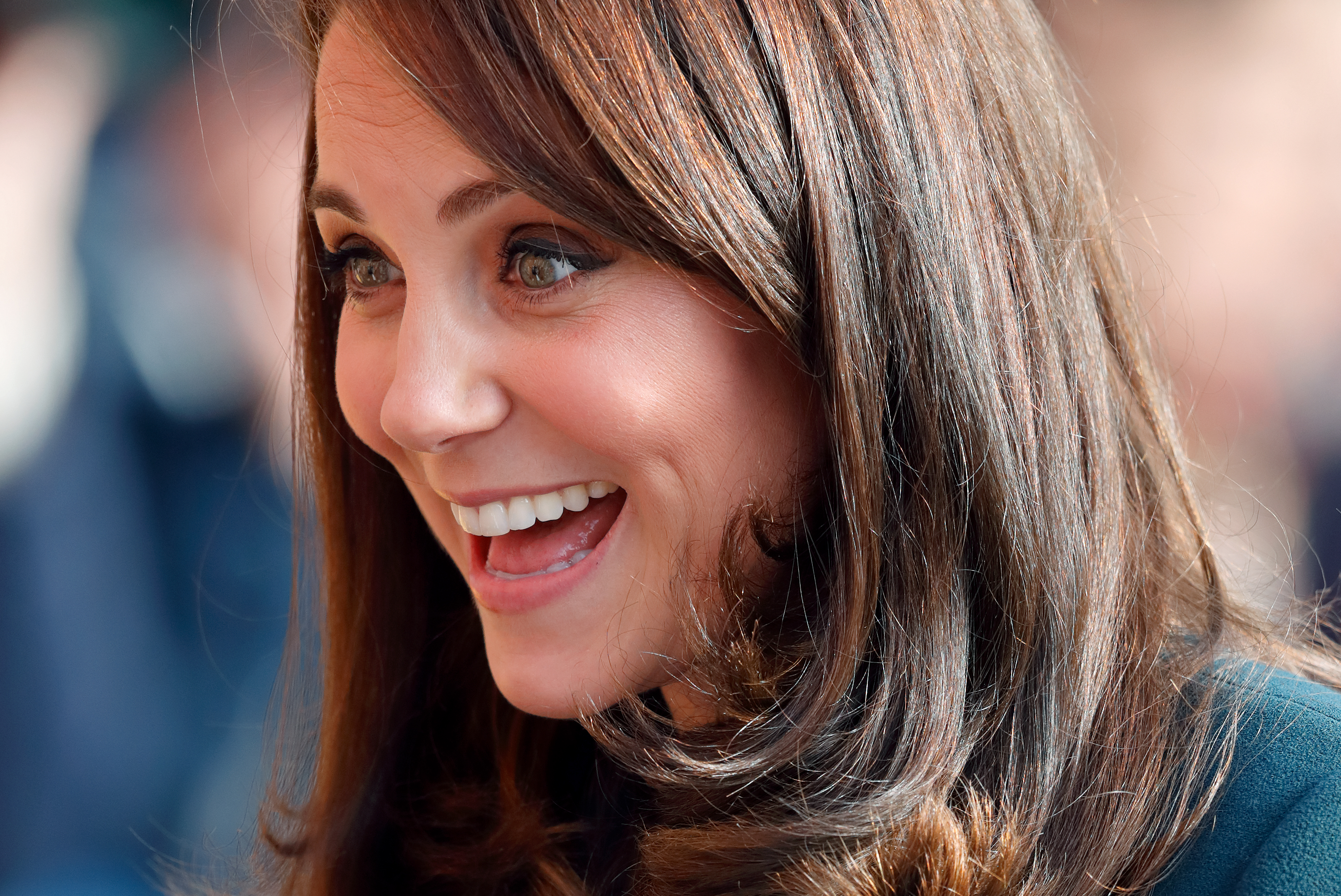 The Reason Kate Middleton Has a Large Scar On Her Head