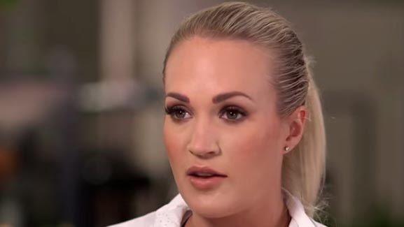 carrie-underwood-face-injury