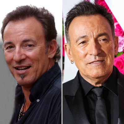 bruce springsteen plastic surgery getty images