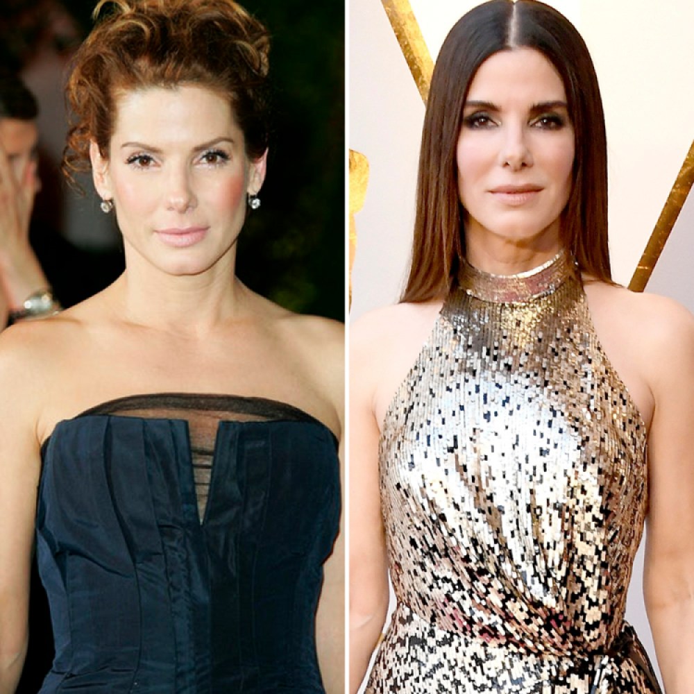 Sandra Bullock Plastic Surgery — Experts Weigh in on Her Botox