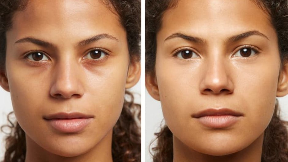 before-and-after-concealer