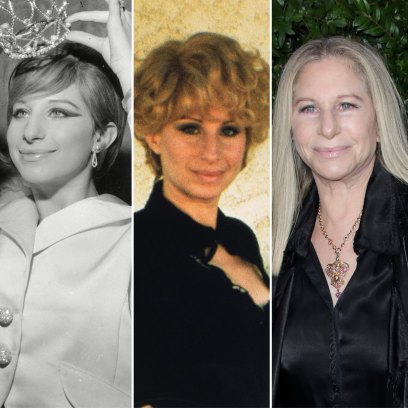 Barbra Streisand Young vs Now Photos: Transformation Pictures 