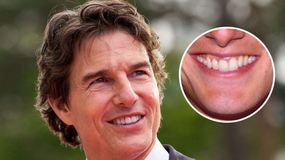 Tom Cruise Teeth: Story Behind Actor's Smile, Middle Tooth