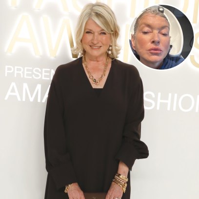 Did Martha Stewart Get Plastic Surgery? Photos, Skincare