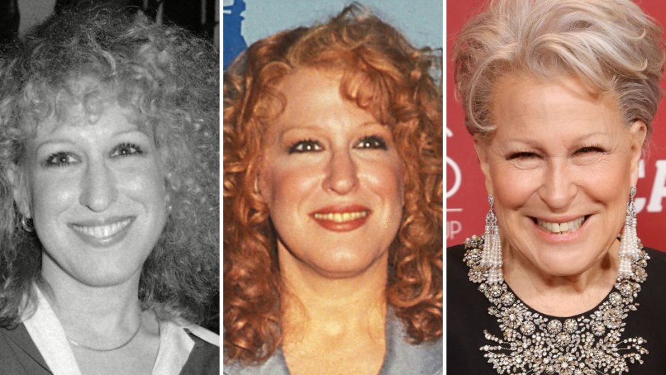 Bette Midler Plastic Surgery Photos: Before, After Pictures