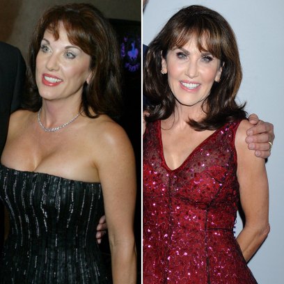 Robin McGraw Plastic Surgery: Photos, Candid Quotes 