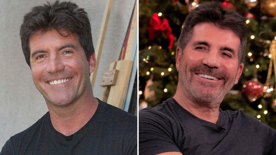 Did Simon Cowell Get Plastic Surgery? Candid Quotes