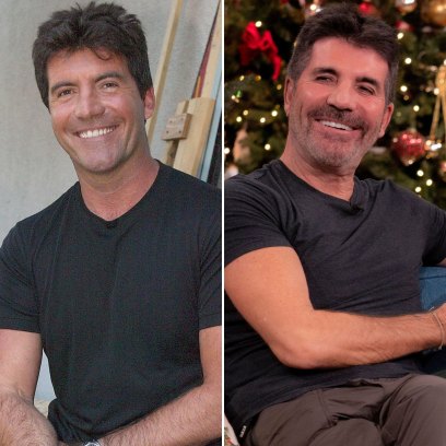 Did Simon Cowell Get Plastic Surgery? Candid Quotes