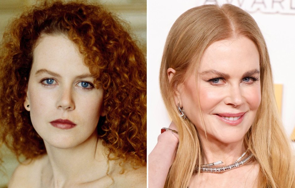 Nicole Kidman Addressed Plastic Surgery Rumors: Photos