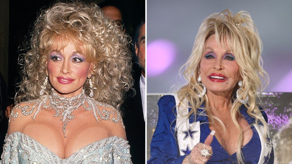 Dolly Parton's Most Revealing and Jaw-Dropping Outfits [Photos]