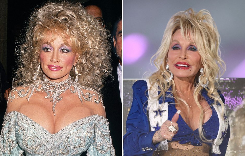 Dolly Parton's Most Revealing and Jaw-Dropping Outfits [Photos]