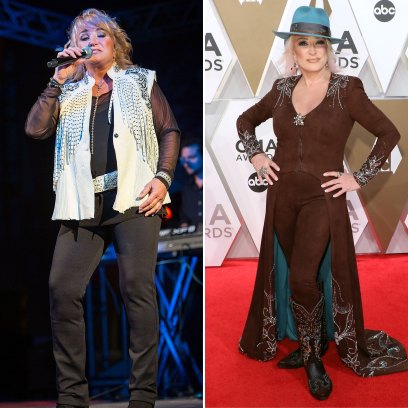 Tanya Tucker’s Weight Loss: See Before and After Photos