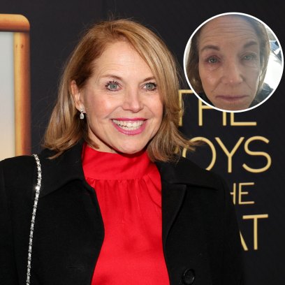 Katie Couric Reflects on Eczema Battle With Makeup-Free Selfie