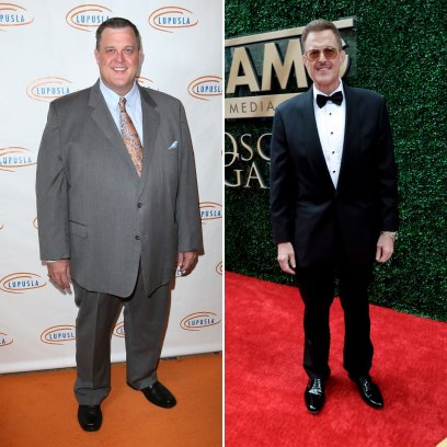 How Did Billy Gardell Lose Weight? Surgery and Transformation